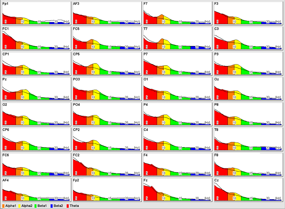 Figuur 7. Gemiddelde power van mannen en vrouwen in de 5 verschillende frequentiebanden (theta, 4-7 Hz; alpha1, 8-10 Hz; alpha2, 10-12 Hz; beta1, 13-18 Hz; en beta2, 18,5-24 Hz) voor de 32 kanalen.