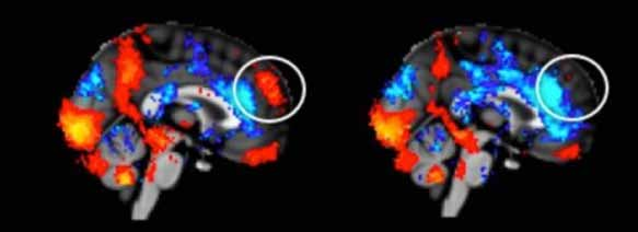 Een sterk merk aan het werk Bron: Neurensics Emotiegebieden Bij het wetenschappelijk onderzoeken van de neurologie wordt onder andere gekeken naar de verschillende emotiegebieden in onze hersenen.