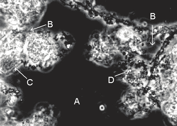 The interstitial water is kept in the interstice of the sludge particles and micro organisms in the sludge floc. This water is bound physically by active capillary forces.