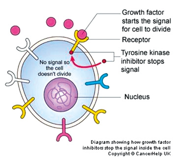 2 GIST Gastro Intestinale Stromale Tumor is een vorm van kanker die, anders dan de meeste vormen van kanker, niet behoort tot de carcinomen, maar tot de sarcomen. Sarcomen zijn met 1.