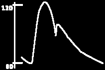 Opgve 6: (4x5=20 punten) (Bij deze opgve is gebruik vn resultten uit de bijlge bij opgve 6 noodzkelijk) Is de leeftijd vn volwssenen zonder gezondheidsproblemen vn invloed op de hoogte vn hun