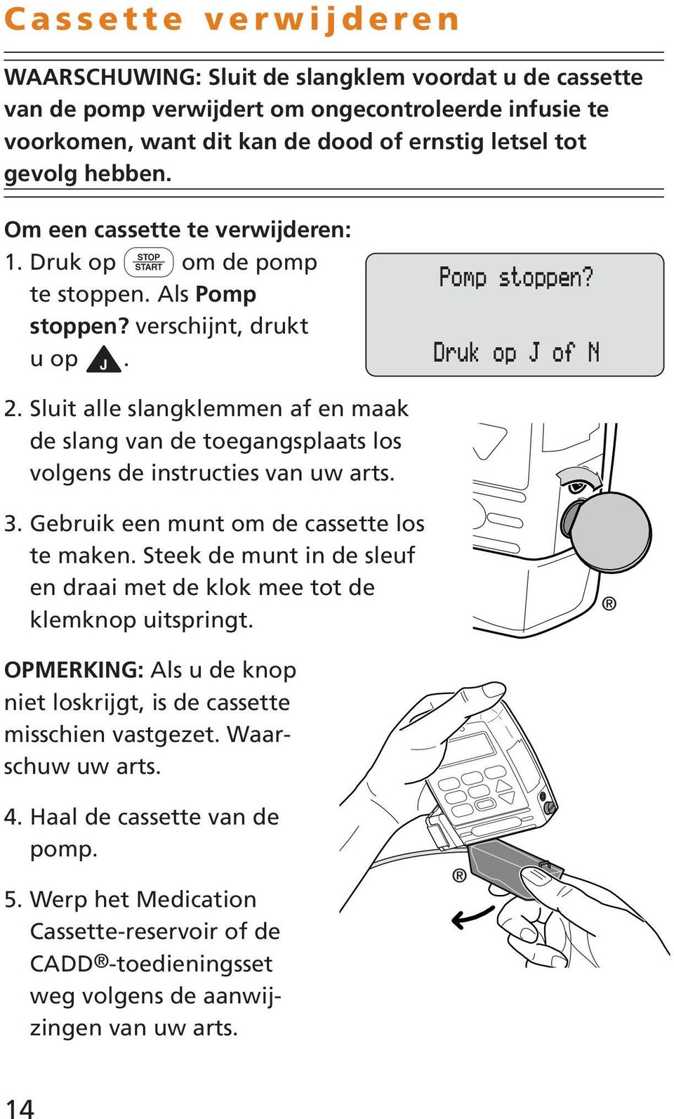 Sluit alle slangklemmen af en maak de slang van de toegangsplaats los volgens de instructies van uw arts. 3. Gebruik een munt om de cassette los te maken.