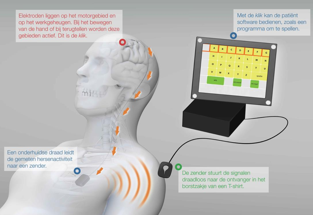 Brain computer interface