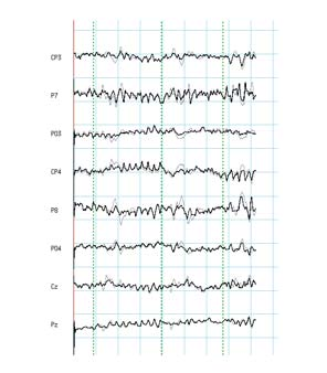 Op dit moment zijn twee studies gepubliceerd waarin op deze wijze met behulp van EEG/fMRI naar de bronnen van het alfaritme is gekeken.