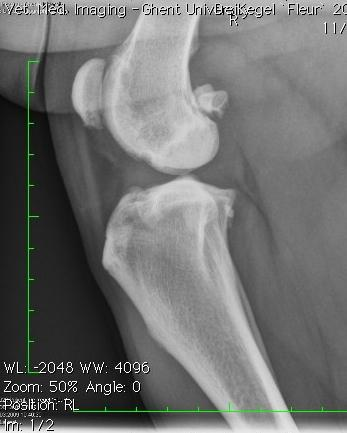 osteoarthrose. Fig. 7: Rechter kniegewricht.