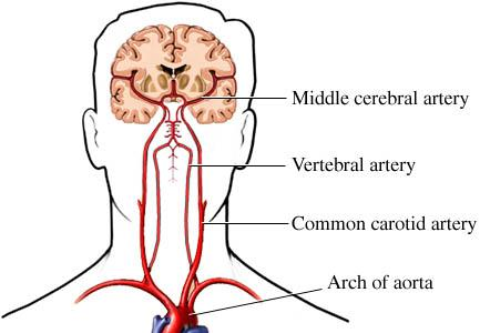 Cerebrale