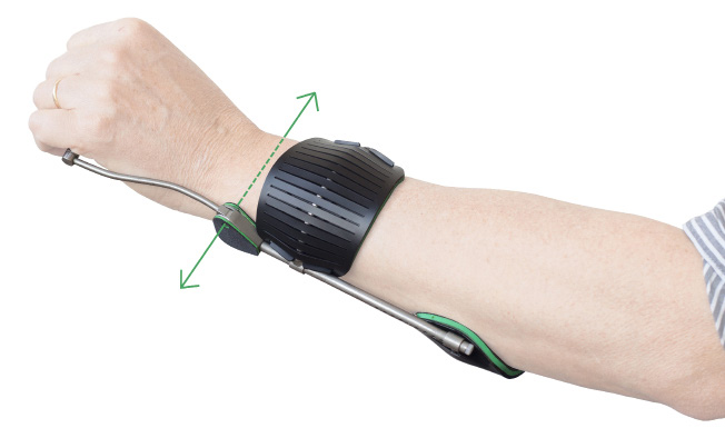 De distale pelottedrager ligt vlak achter de pols aan de bovenzijde van de arm, zodanig dat geen hinder wordt ondervonden bij polsflexie.