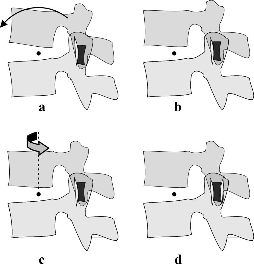Figuur 12a t/m d. Modelmatige voorstelling van de vergrendeling van de flexie-beweging via een rotatie.