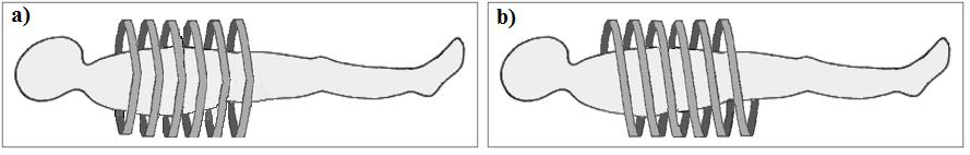 Om verschillende transversale slices van de patiënt te bekomen, beweegt de tafel volgens de z- as. Er zijn twee methodes mogelijk zoals weergegeven in figuur 4.