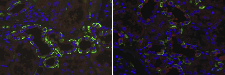 Indirecte immuunfluorescentie: antistoffen tegen AE1!