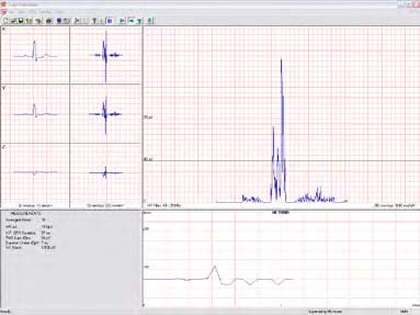 Afmetingen: 17 x 9 x 3 cm Gewicht: 300 gram Communicatie interface: USB ECG sampling rate: 16.