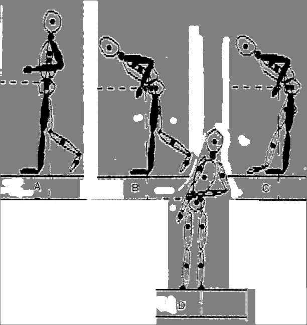 Figuur 1. Mechanisme van de kleefgang bij een positieve steunreaktie. De linker enkel wordt slechts 5 0 in plantairflexie gehouden. Zwart: linker arm en been, Open: rechter arm en been.