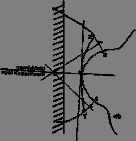 Figuur 9 Gewrichtsvorm van het laag thoracale art. costotransversaria met daarin de konstruktie van het GRC.