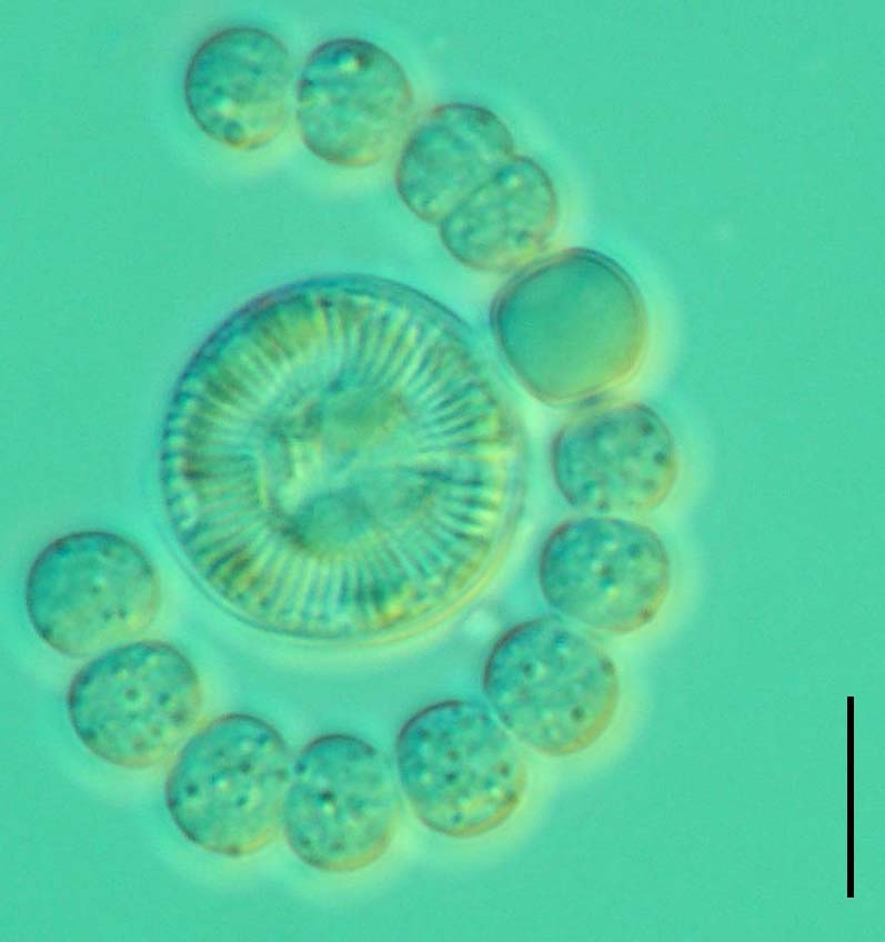 Bespreking van de monsterpunten goudwier Chrysochromulina parva. Aphanocapsa is een indicator voor mesotroof water (Joosten, 2006).