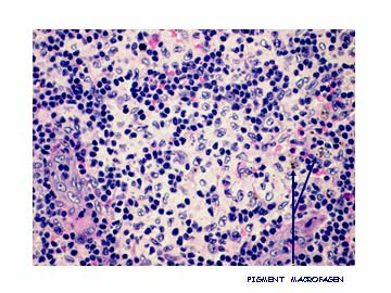 functionele betekenis: reactie op antigeen aanbod via de huid differentiaal diagnose: lymfeklier aantasting door