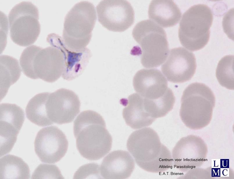 Materiaal 2015.4B Plasmodium vivax PCR geconfirmeerd 61/78 correcte uitslag: P. vivax Onjuiste resultaten: P. malariae (13x) P. knowlesi (1x) P. malariae + P. vivax (1x) P. species (1x) P.
