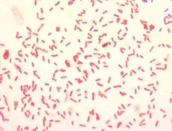 Gram negatieve staven veel soorten, o.a. Enterobacteriaceae (o.