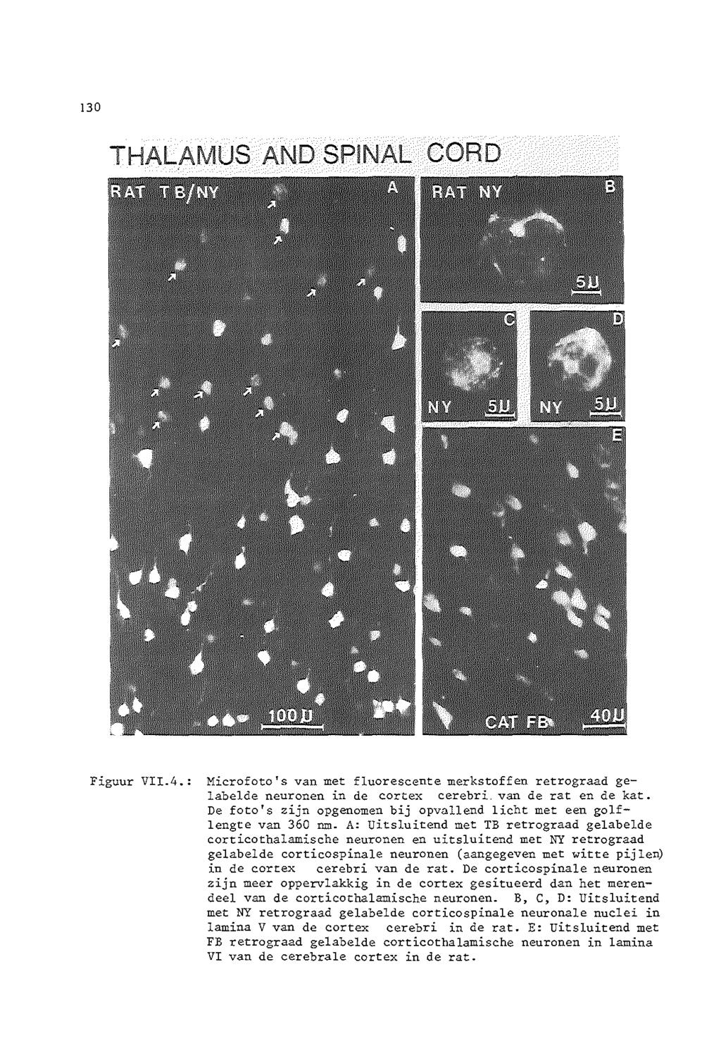 !30 THALAMUS AND SPINAL CORD Figuur VII.4.: Microfoto's van met fluorescente merkstoffen retrograad gelabelde neuronen in de cortex cerebri. van de rat en de kat.