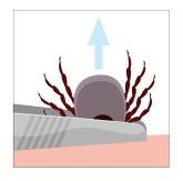 Pak de teek met een puntig pincet zo dicht mogelijk op de huid bij de kop vast en trek hem er langzaam uit. Als een stukje van de kop achterblijft, is dat ongevaarlijk.