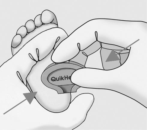 Dit kan het bloedonderzoek verstoren. Massage in de overdwarsrichting van het voetje Druk nu met de wijsvinger de witte knop in. Na activatie wordt het mesje automatisch en permanent beschermd.