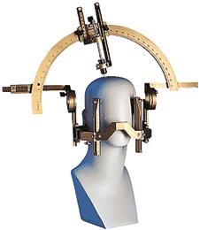 Behandeling Op de dag van de operatie krijgt u eerst een frame op uw hoofd aangemeten. Dit is een raamwerk waarmee de neurochirurg precies kan meten waar de elektroden ingebracht moeten worden.