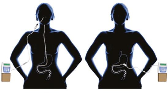 Besluit Na een week komt u weer terug in het ziekenhuis. Er wordt door de (parkinson)neuroloog, u en eventueel uw mantelzorger/partner bekeken of u: 1.