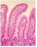 nieuwe voeder - Behoud van structuur van darmvlokjes is belangrijk Darmvlokjes hoogte (µm) Crypte diepte (µm) 400 375 350 325 300 275 250