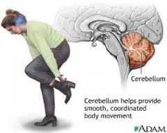 Cerebellaire Dysfunctie = Dysmetrie Dysmetrie van bewegen (ataxie het cerebellair motorische syndroom)