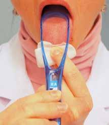 REINIGEN VAN DE TONG De tong is ruw van structuur en daardoor blijven er veel bacteriën en voedselresten op achter. Het is niet nodig om de tong regelmatig te reinigen.