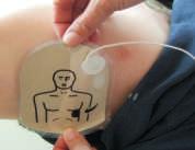 Haal plakelektroden van strip Plaats plakelektroden op borstkas van patiënt