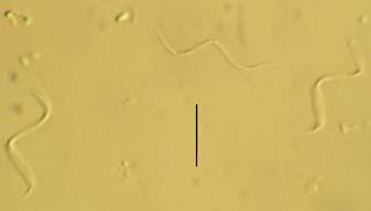 De belangrijkste daarvan zijn Cryptomonas, cf. Glaucospira en Syncrypta elaeochrus.