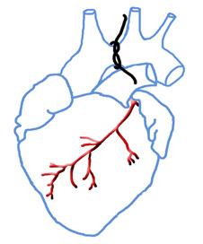 artery ligation Pressure overload 8 wk Transverse Aorta