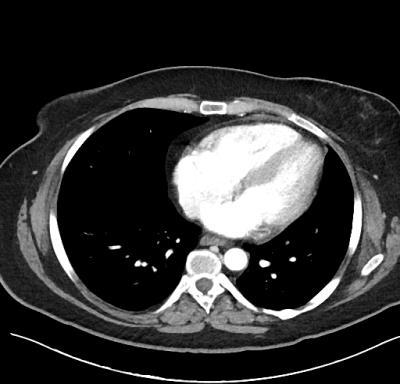 American Journal of Respiratory