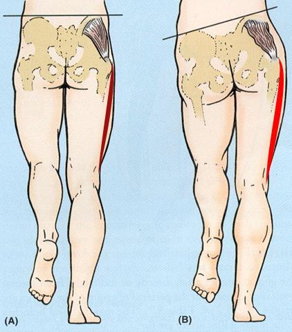 De symptomen 1. Geleidelijke ontstane inspanning gebonden knie-pijn aan de buitenzijde van de knie (ter hoogte van de laterale epicondyl) tijdens hardlopen of direct erna. 2.