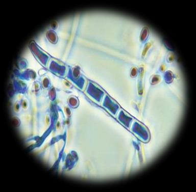 Dermatofyten kunnen onderverdeeld worden in volgende drie geslachten: Trichophyton, Epidermophyton en Microsporum.