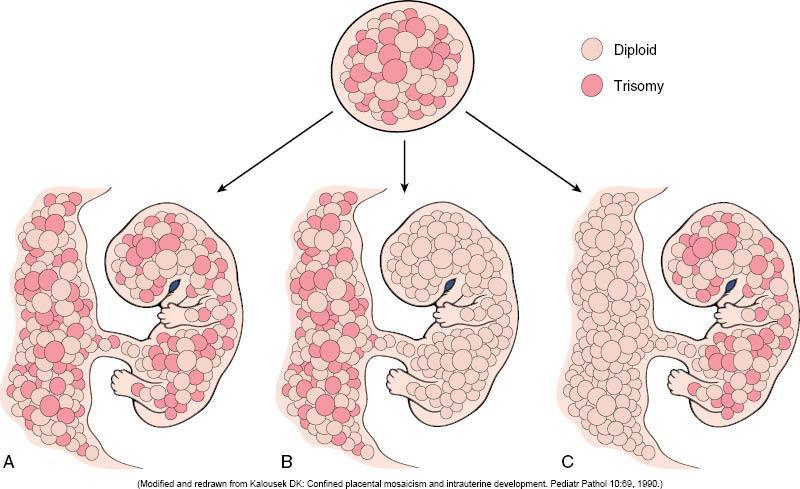 NORMAAL TRISOMIE (mozaiek) afwijking in foetus EN placenta meest voorkomend (mozaiek) afwijking NIET in foetus