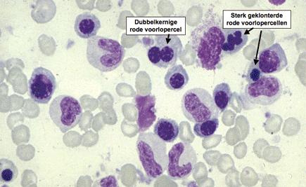 Geneesmiddelen (hydrea) vitamine B12 en/of foliumzuur