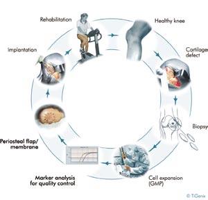 Tigenix Kraakbeenbehandeling met ChondroCelect: Indicaties, Celtechnologie en Chirurgie TiGenix Symposium Auditorium 12 uur Introductie door moderator Indicatiestelling Dr.