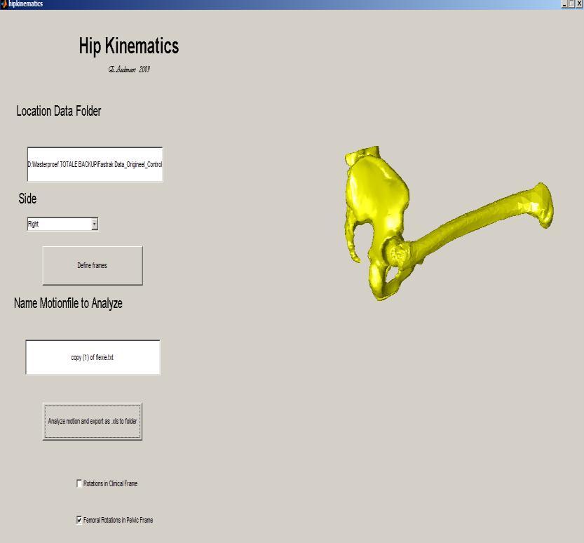 De output van het programma bestaat uit een visuele controle van een modelfemur die de geregistreerde beweging in het pelviene frame beschrijft en uit een excelbestand waarin de verandering in