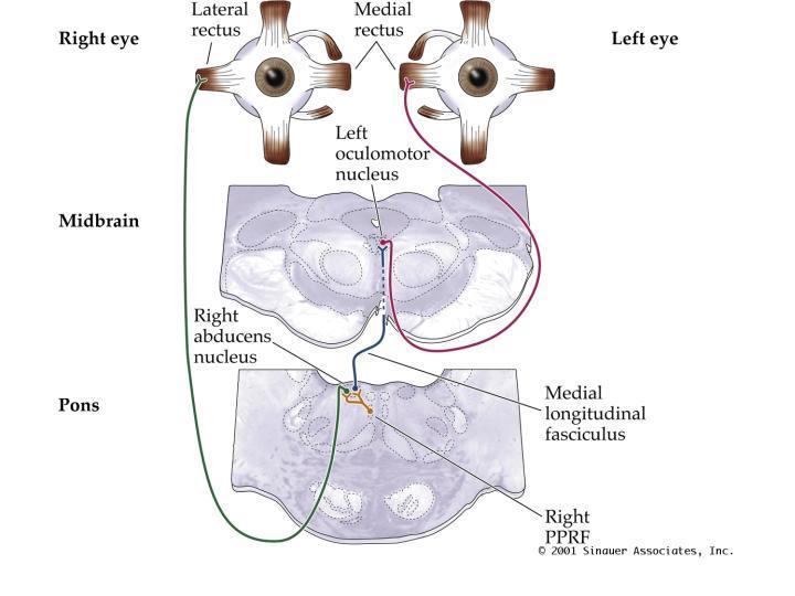 Dubbelzien en nystagmus Internucleaire ophthalmoplegie Adductie