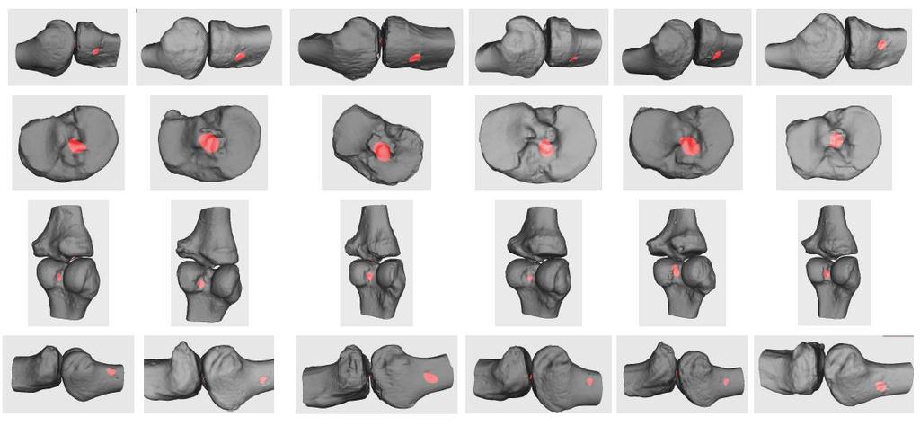 BIOMECHANICA VAN HET KNIEGEWRICHT Analyse van de tunnelposities van de FE