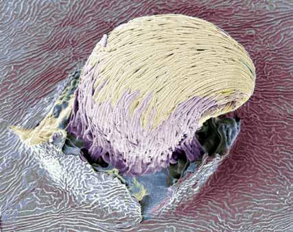 Een sporenmassa van de schimmel Sphaerulina oxycanthae breekt door een blad. De langwerpige sporen zitten samengepakt in een bundel.