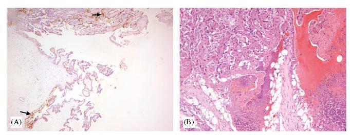 Placenta - geiten 19/29 Immunohistochemie (x50) A: Trofoblastcellen van het chorion C.
