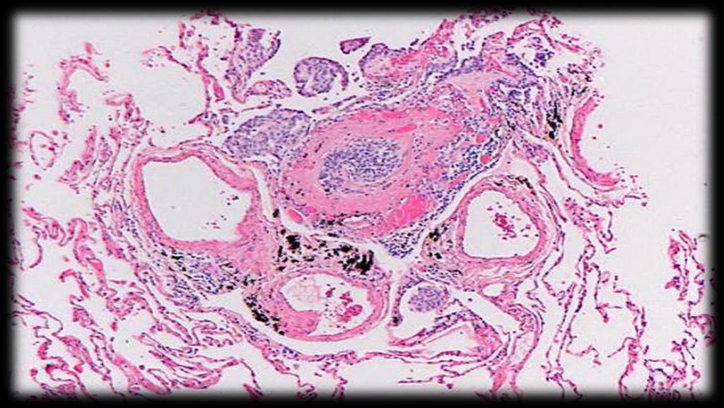 Achtergrond Tumor let/