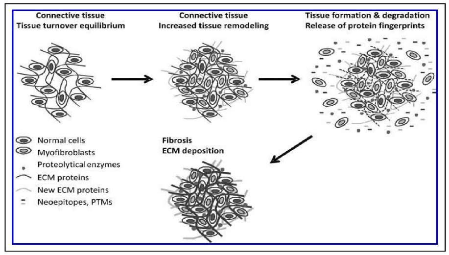 Zoals weergegeven in bovenstaand figuur weergegeven, resulteert kankercelmetastase in een uitgebreide ECM remodelering (ECMR), wat resulteert in de vrijlating van matrix componenten, waaronder