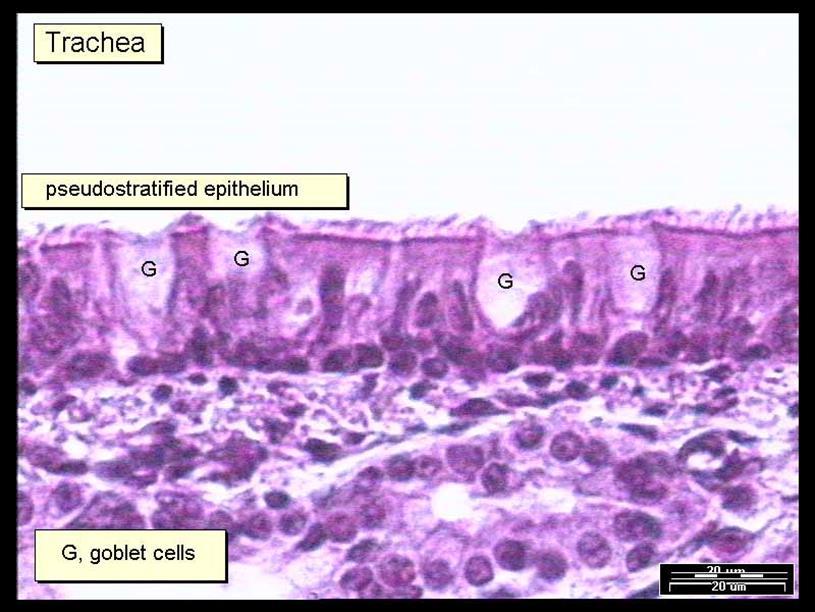 Pro-thrombotic effects Induceren