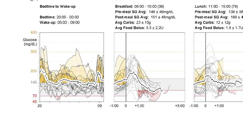 -uurs analyse analyse Sensor, insuline en en instellingen -uurs Sensor, insuline instellingen. De rood gearceerde gebieden geven de momenten dat u in dit glucosebereik was aan.