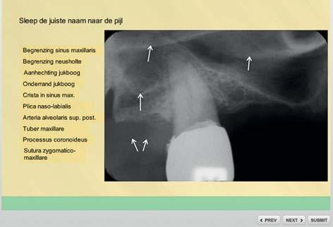 a b c d Afb. 3. Enkele schermafbeeldingen van diverse applicaties die in de digitale leeromgeving aan de opleidingen tandheelkunde van ACTA en Radboudumc worden aangeboden.