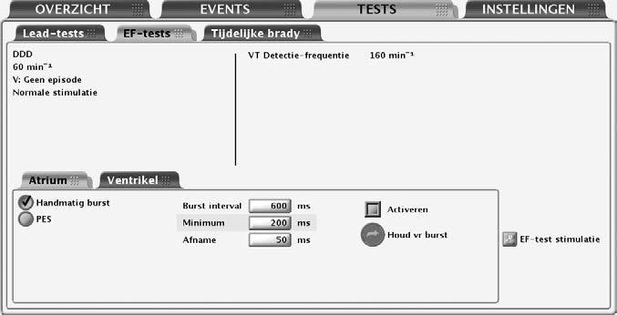 5-2 Elektrofysiologische testen EF-testfuncties EF-TESTFUNCTIES EF-testscherm De elektrofysiologische (EF) testfuncties stellen u in staat op niet-invasieve wijze aritmieën op te wekken en te