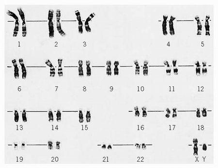 1. Hoeveel haplotypes van HLA genen heeft elke